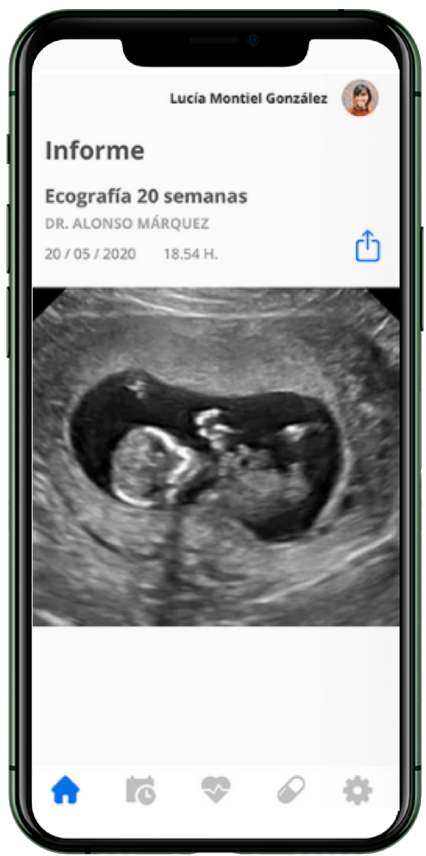 Pantalla 2